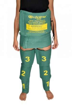 Paciente simulado de pie con Traje Antishock No Neumático TANN NASG ajustado, color verde con números amarillos, mostrando colocación correcta de los seis segmentos de compresión para hemorragia posparto.